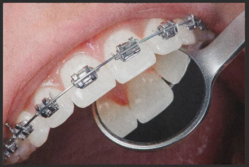 Fussmatte Kieferorthopäde 6146